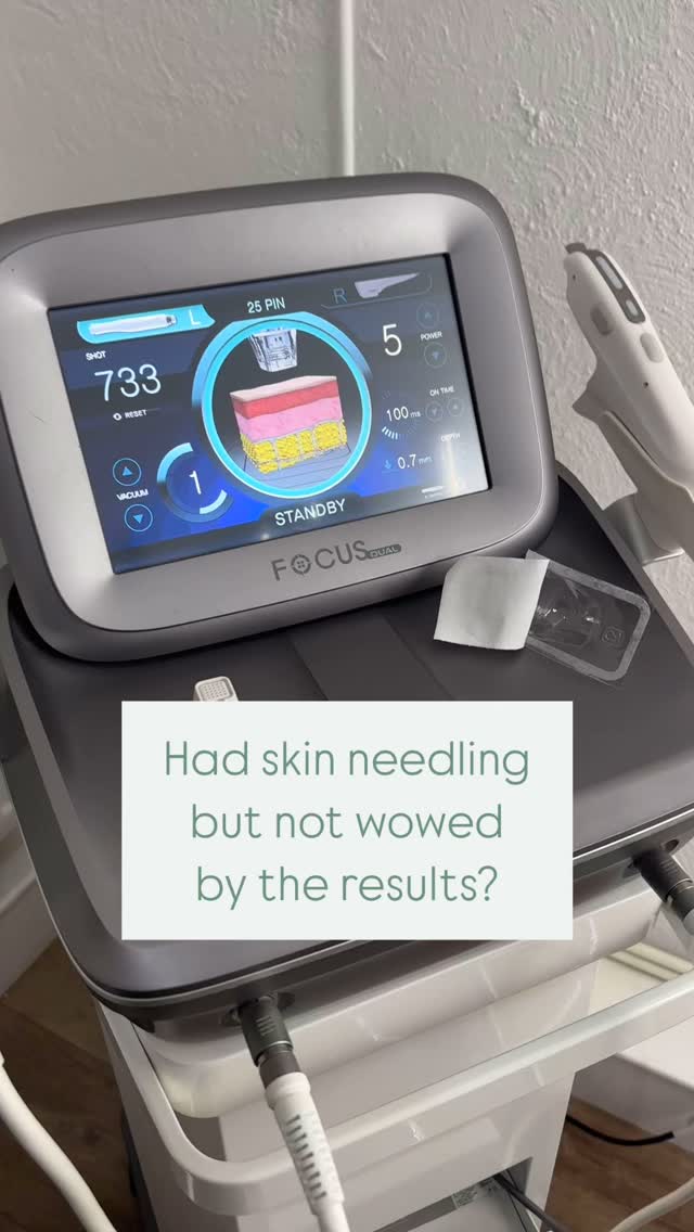 RF MicroNeedling with a device like Focus Dual delivers more than your standard skin needling treatment.
Controlled and precise, giving you a huge collagen boost with an expert medical grade device, and the extra skin tightening benefit of radio frequency as standard 🌟
Still think all skin needling is the same?
Want to know more about adding RF MicroNeedling into your skin plan, or for other skin advice book a consultation or get in touch.
Bookings can be made via the online links.
#rfmicroneedlingcumbria #skintreatmentscumbria #skincliniccumbria #facialscumbria #southlakes #skinadvicecumbria #lakedistrict #lancashire