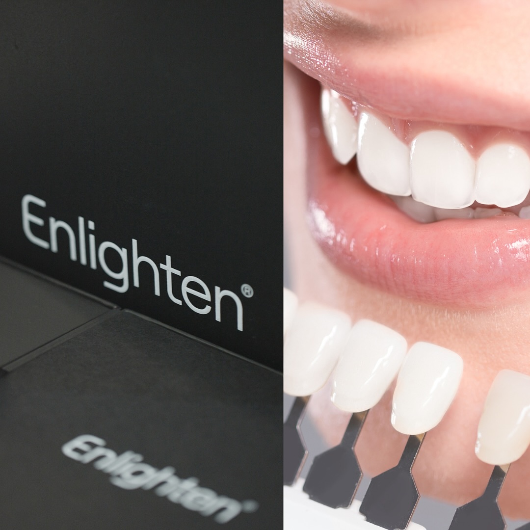 For a brighter, long-lasting smile, home whitening is the most effective approach. After your initial appointment, we’ll create custom-fitted trays designed for your comfort, ensuring they won’t cause any discomfort to your teeth or gums.
These trays act as a base for the teeth whitening gel, which you’ll apply and typically wear overnight while you sleep. We will guide you on the right amount of gel to use, as well as how to properly place and remove the tray.
In just three weeks, you’ll achieve the radiant white smile you’ve always wanted. This method requires minimal intervention and is gentle on your teeth.
You’ll only need to return for additional whitening syringes every few years, or sooner if you wish to maintain a brighter shade. The top-up process is quick and typically takes just a couple of nights.
Benefits 👇
✅ Predictable and effective results
✅ Pain-free procedure
✅ Natural-looking outcomes
✅ Noticeably whiter smile in just 3 weeks
✅ Uses a lower concentration of bleaching gel compared to other methods
Get in touch with our team to book your appointment - we look forward to seeing you soon!
The London Centre For Prosthodontics
29 Weymouth Street
London, W1G 7DB
020 7637 4518
info@londonprosthodontics.com
Monday - Friday: 7:30am - 4:30pm
Saturday & Sunday: Closed
#MaryleboneDentist #LondonSmiles #HealthyTeethMarylebone #DentalCareLondon #SmileMakeover #MaryleboneOralHealth #LondonDentalExperts #CosmeticDentistry #TeethWhiteningMarylebone #EmergencyDentistLondon #MaryleboneOrthodontics #LondonDentalClinic #DentalCheckup #MaryleboneDentalCare #SmileTransformation
#LondonOralCare #MaryleboneDentalHealth #FamilyDentistLondon #TeethCleaningMarylebone #CosmeticDentistLondon #MaryleboneTeeth #LondonDentalHygiene#MaryleboneOrthodontist #OralWellnessLondon #PreventiveDentistry #MaryleboneDentalServices #LondonDentalSpecialists #MaryleboneHealthySmiles #LondonDentistry #AdvancedDentalCare